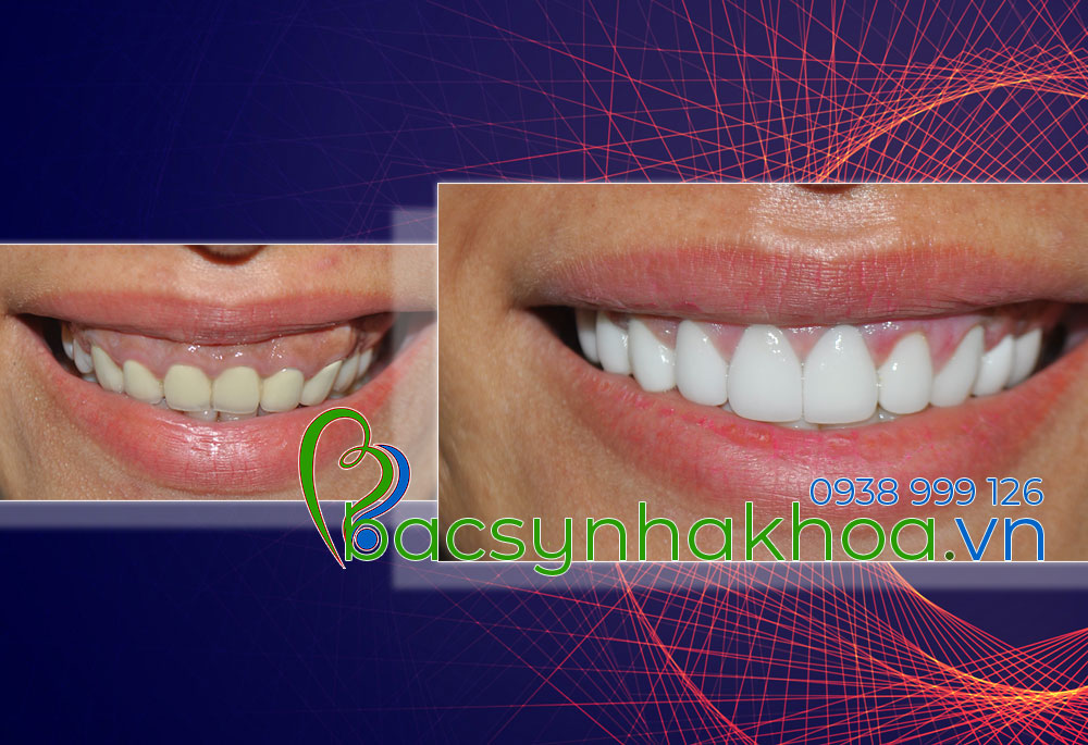 http://bacsynhakhoa.vn/img/bacsynhakhoavn-cuoi-ho-loi-Thuy-Nga.jpg