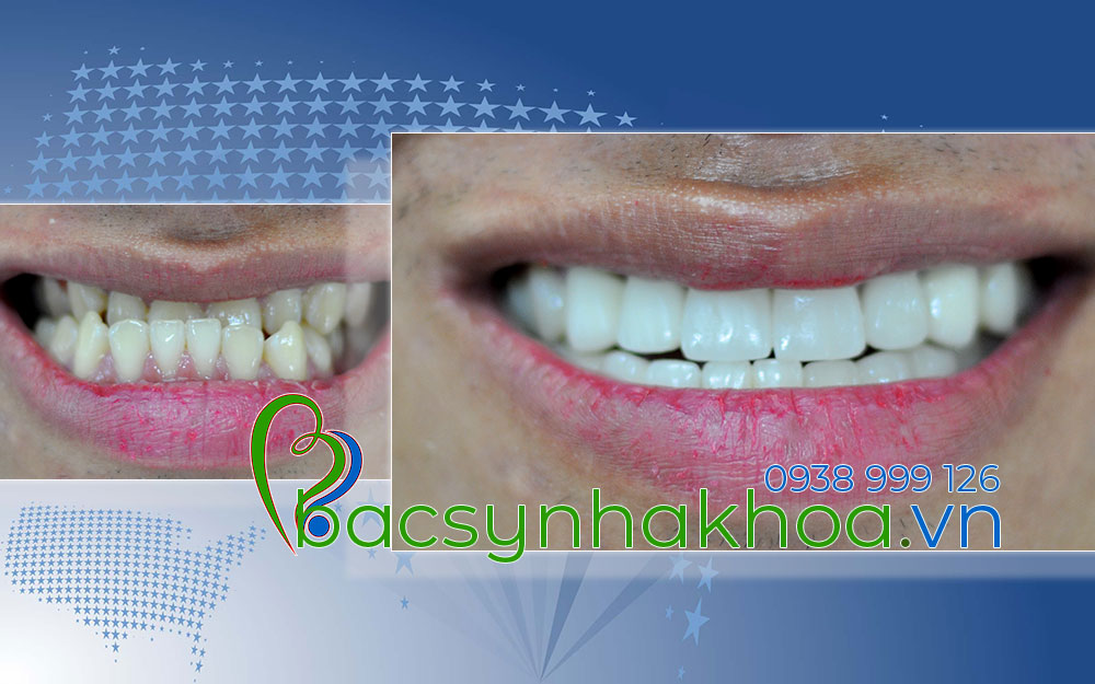 http://bacsynhakhoa.vn/img/bacsynhakhoavn-rang-cua-bi-mom-Quang.jpg