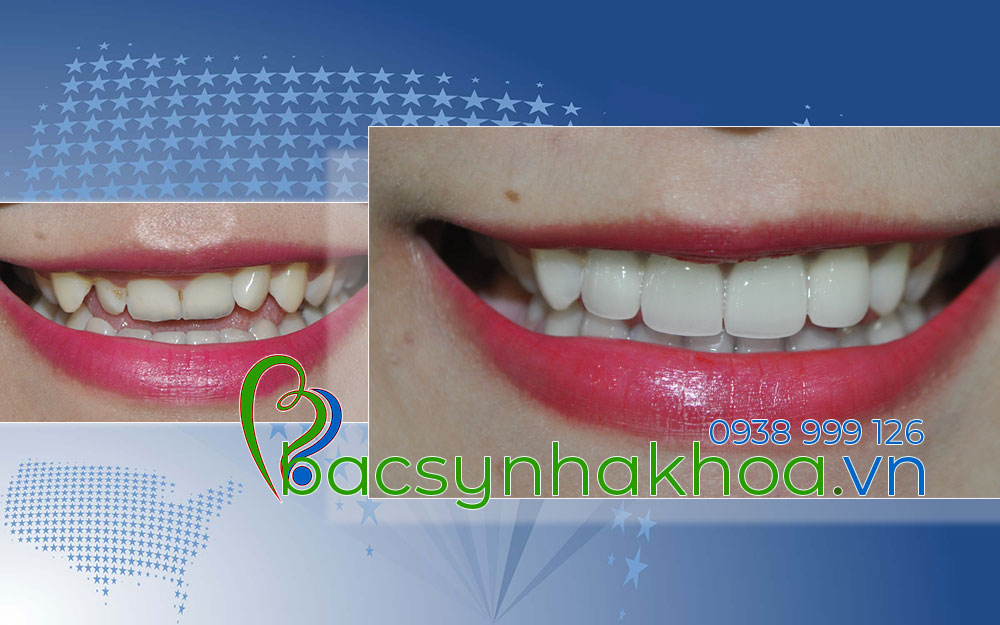 http://bacsynhakhoa.vn/img/bacsynhakhoavn-rang-mom-Cuc.jpg