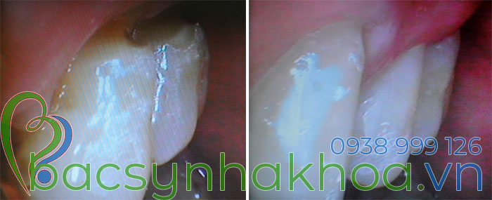http://bacsynhakhoa.vn/img/bacsynhakhoavn-rang-mon-co.jpg