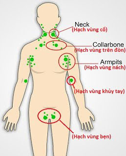 https://bacsynhakhoa.vn/img/galaxy-dental-cac-vi-tri-thuong-sung-hach.jpg