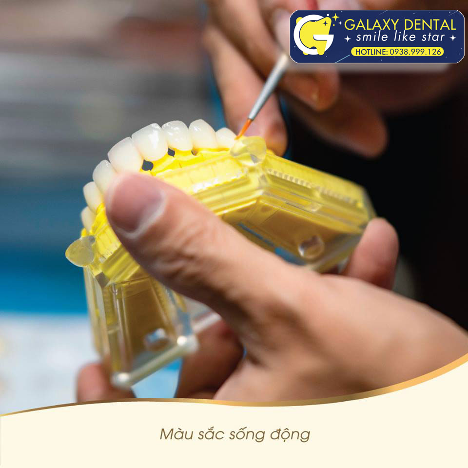 https://bacsynhakhoa.vn/img/galaxy-dental-che-tao-rang-su.jpg