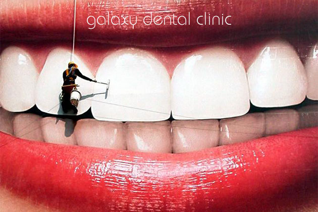 https://bacsynhakhoa.vn/img/galaxy-dental-cong-nghe-lam-trang-rang.jpg