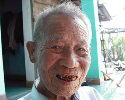 https://bacsynhakhoa.vn/img/galaxy-dental-cu-Han-o-Ha-Tinh-moc-lai-rang.jpg