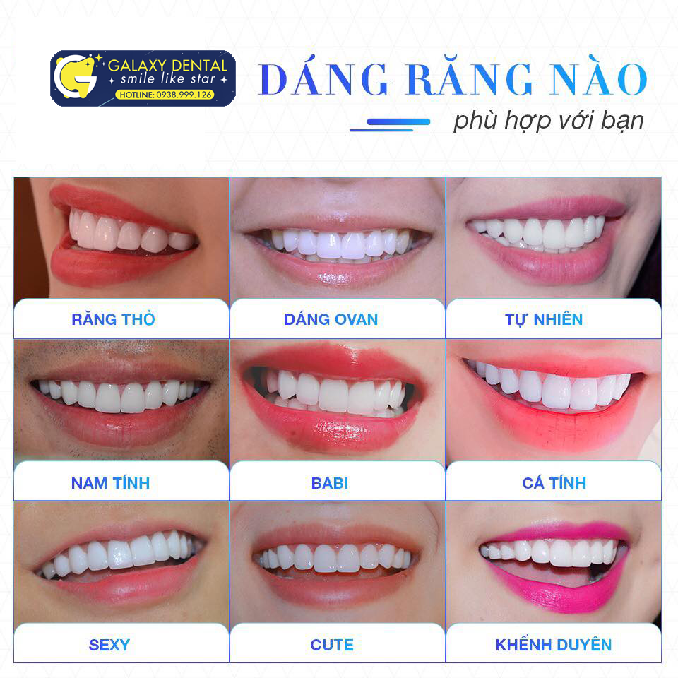 https://bacsynhakhoa.vn/img/galaxy-dental-dang-rang-nao-phu-hop-voi-ban-01.png