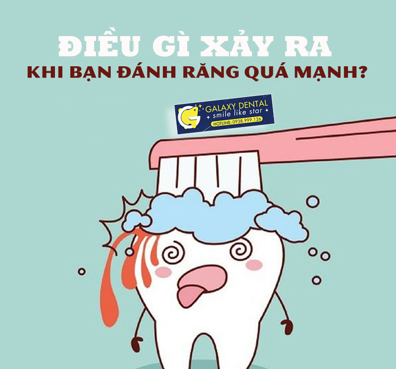 https://bacsynhakhoa.vn/img/galaxy-dental-dieu-gi-xay-ra-khi-ban-danh-rang-qua-manh.jpg