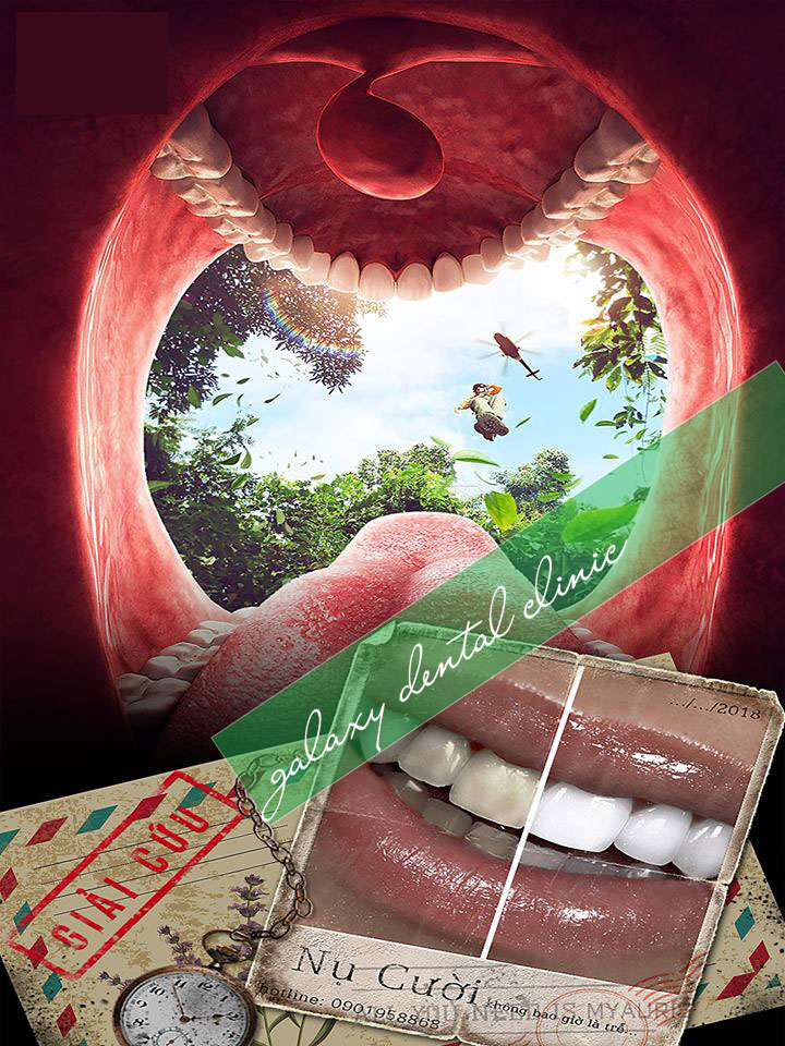 https://bacsynhakhoa.vn/img/galaxy-dental-giai-cuu-rang-mieng.jpg