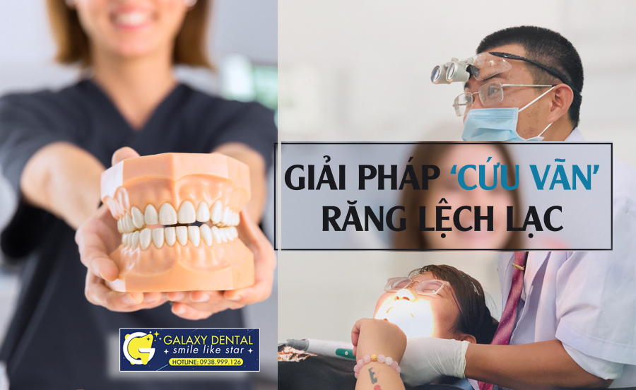 https://bacsynhakhoa.vn/img/galaxy-dental-giai-phap-cuu-van-rang-lech-lac.jpg