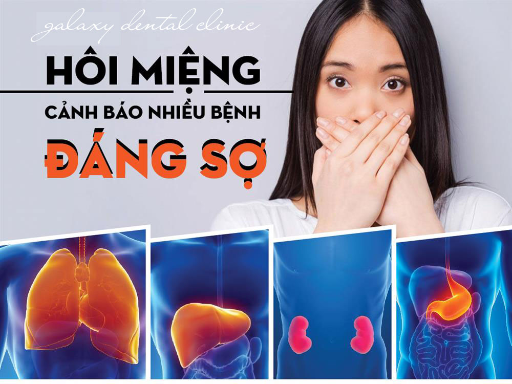 https://bacsynhakhoa.vn/img/galaxy-dental-hoi-mieng-canh-bao-nhieu-benh-ly-toan-than-khac.jpg