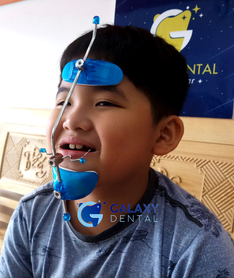 https://bacsynhakhoa.vn/img/galaxy-dental-khi-cu-facemask-huukhang.jpg