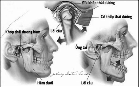 https://bacsynhakhoa.vn/img/galaxy-dental-khop-thai-duong-ham.jpg