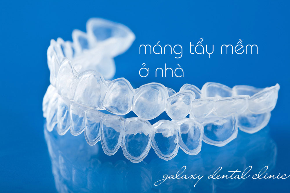 https://bacsynhakhoa.vn/img/galaxy-dental-mang-tay-mem-tay-trang-o-nha.jpg