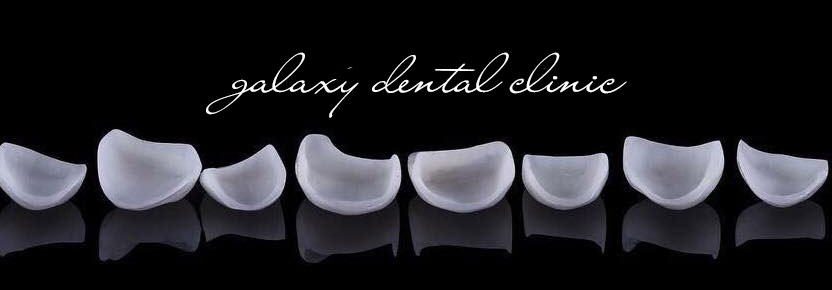 https://bacsynhakhoa.vn/img/galaxy-dental-mat-dan-su-veneer-sieu-mong.jpg