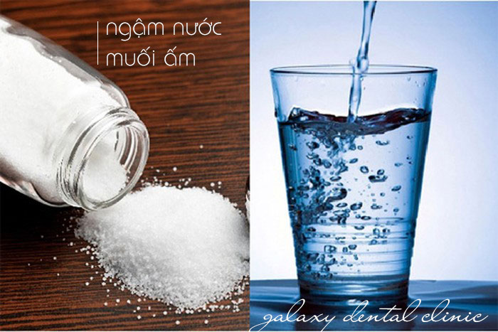 https://bacsynhakhoa.vn/img/galaxy-dental-ngam-nuoc-muoi-am-chua-dau-rang.jpg