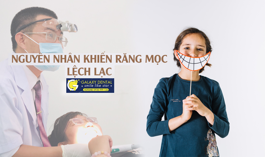 https://bacsynhakhoa.vn/img/galaxy-dental-nguyen-nhan-khien-rang-moc-lech-lac.jpg