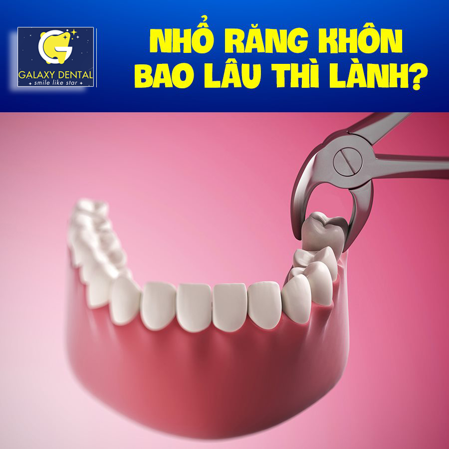 https://bacsynhakhoa.vn/img/galaxy-dental-nho-rang-khon-bao-lau-thi-lanh.jpg