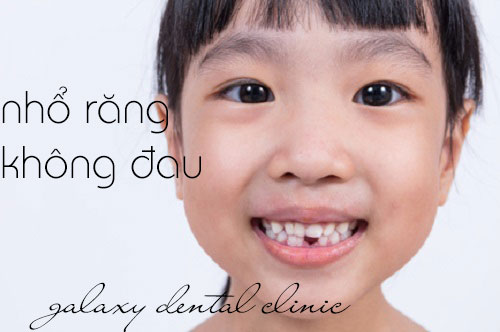 https://bacsynhakhoa.vn/img/galaxy-dental-nho-rang-sua-khong-dau.jpg