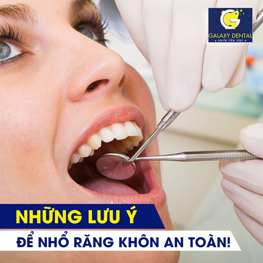 https://bacsynhakhoa.vn/img/galaxy-dental-nhung-luu-khi-nho-rang-khon.jpg