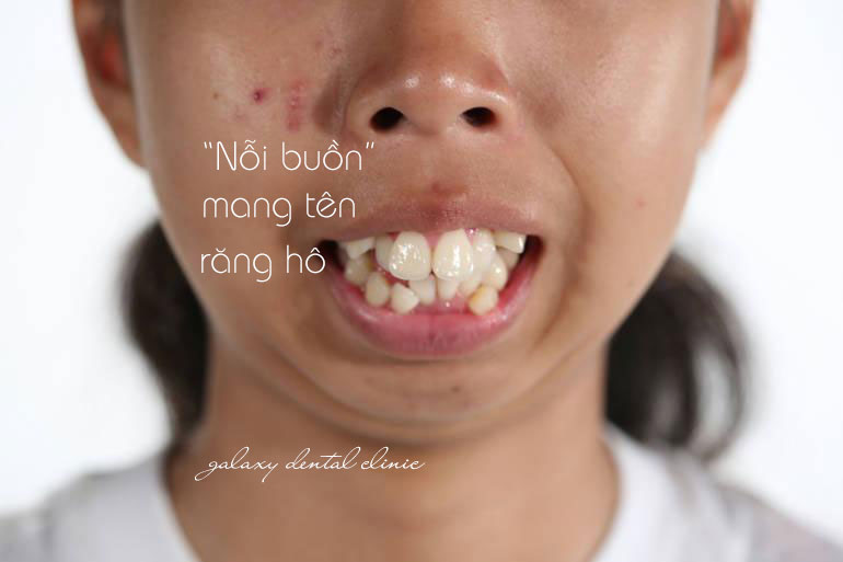 https://bacsynhakhoa.vn/img/galaxy-dental-noi-buon-mang-ten-rang-ho.jpg