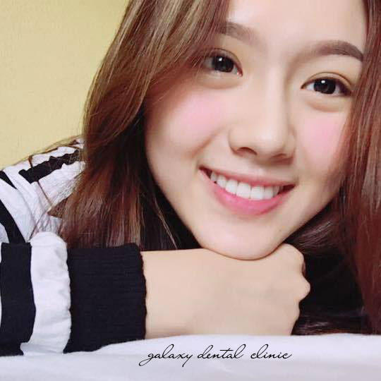https://bacsynhakhoa.vn/img/galaxy-dental-nu-cuoi-thanh-xuan.jpg