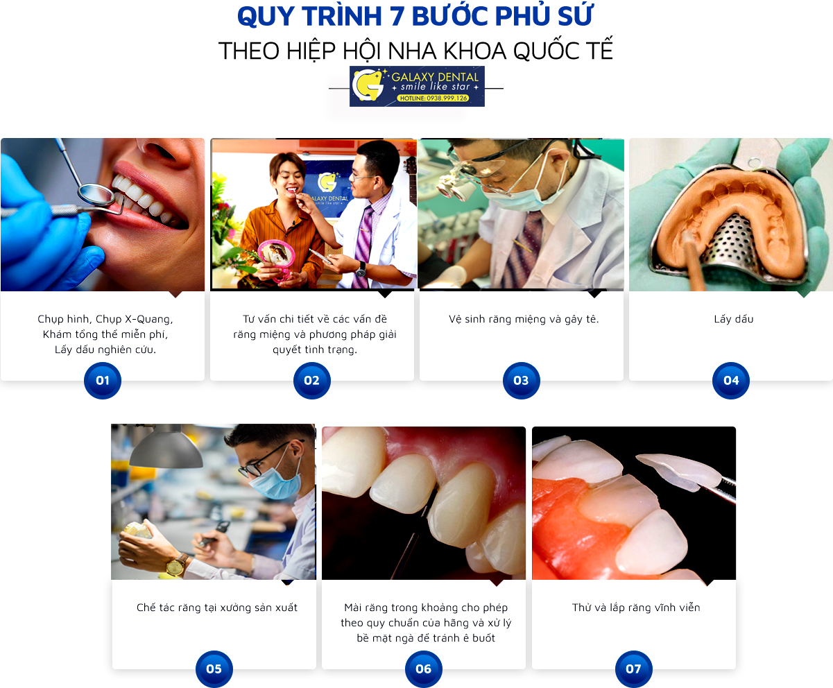 https://bacsynhakhoa.vn/img/galaxy-dental-quy-trinh-lam-rang-su-7-buoc.jpg