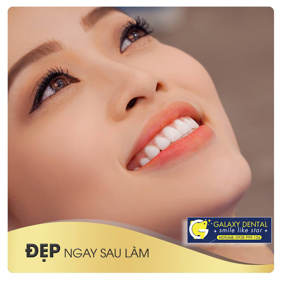 https://bacsynhakhoa.vn/img/galaxy-dental-rang-su-dep3.jpg