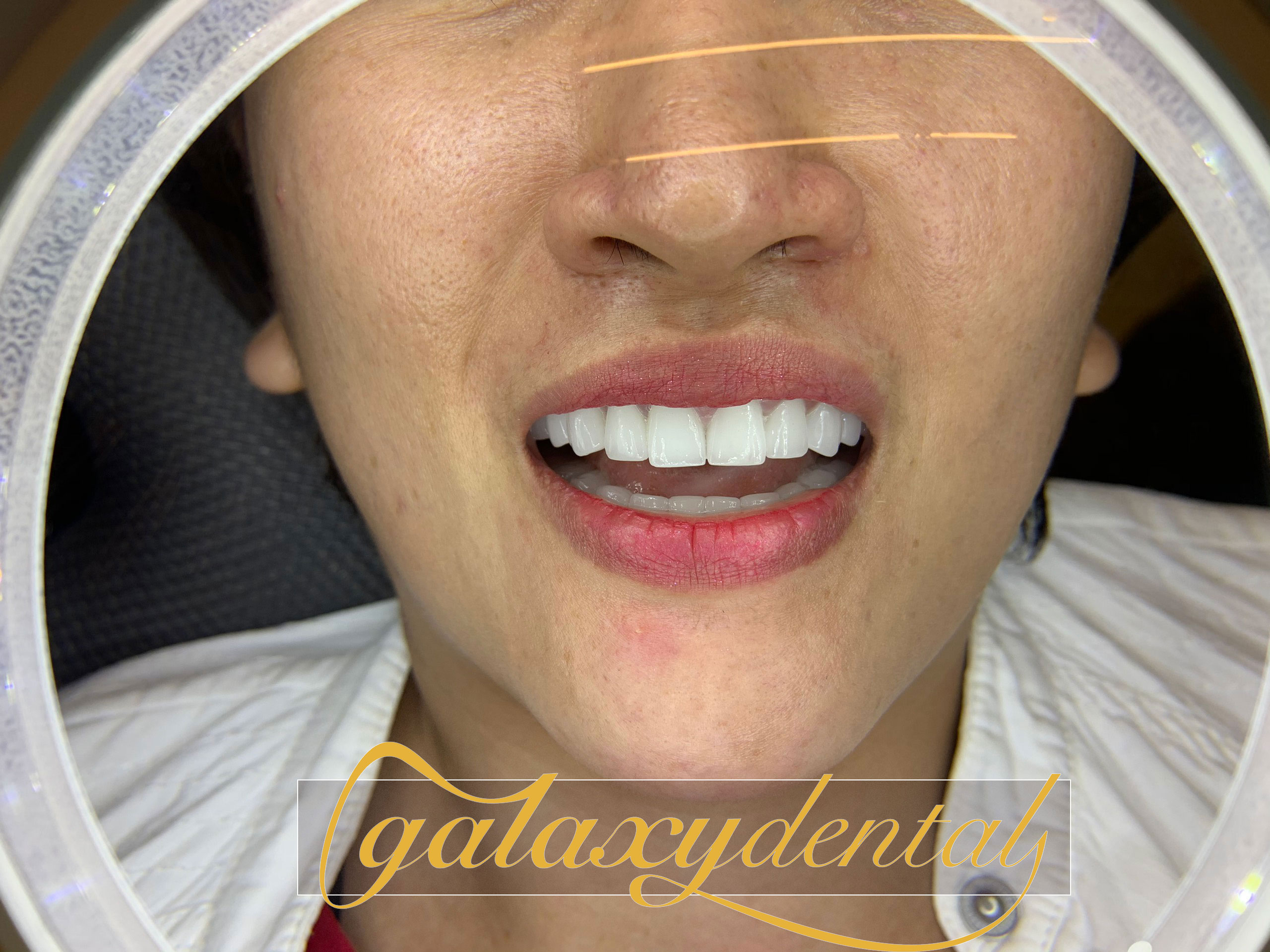 https://bacsynhakhoa.vn/img/galaxy-dental-rang-su-tham-my-huyentrinh.jpg