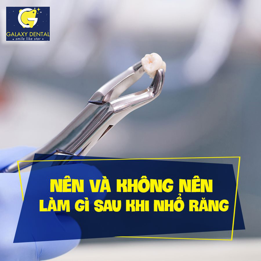 https://bacsynhakhoa.vn/img/galaxy-dental-sau-khi-nho-rang.jpg