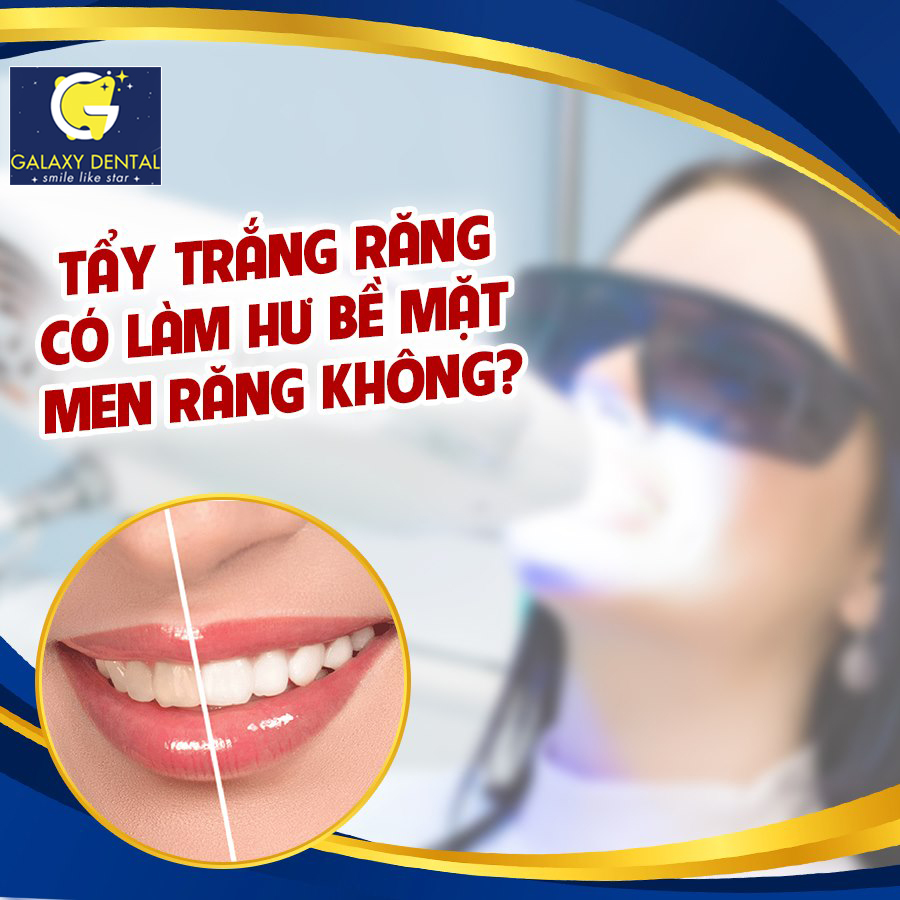 https://bacsynhakhoa.vn/img/galaxy-dental-tay-trang-rang-co-lam-hu-be-mat-men-rang-khong.jpg