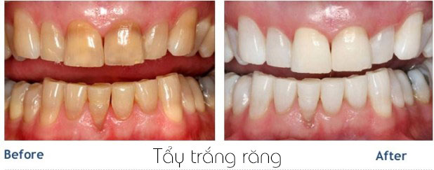https://bacsynhakhoa.vn/img/galaxy-dental-tay-trang-rang.jpg