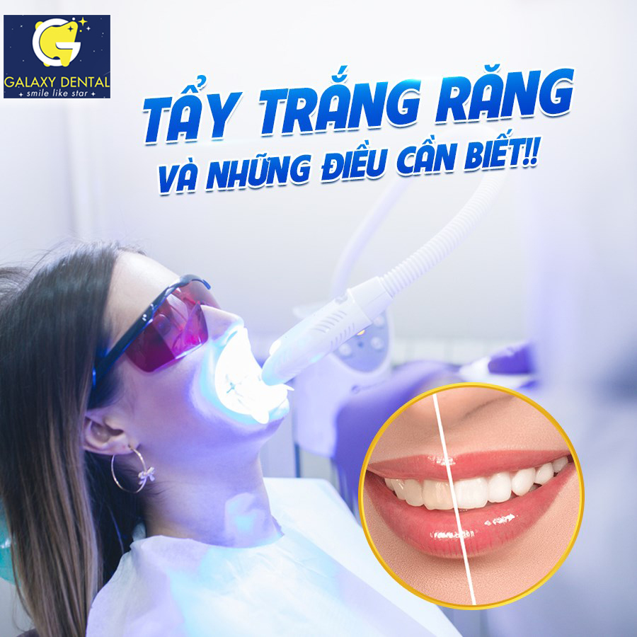 https://bacsynhakhoa.vn/img/galaxy-dental-tay-trang-rang00.jpg