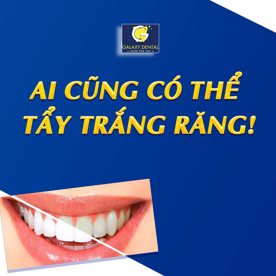 https://bacsynhakhoa.vn/img/galaxy-dental-tay-trang-rang1.jpg