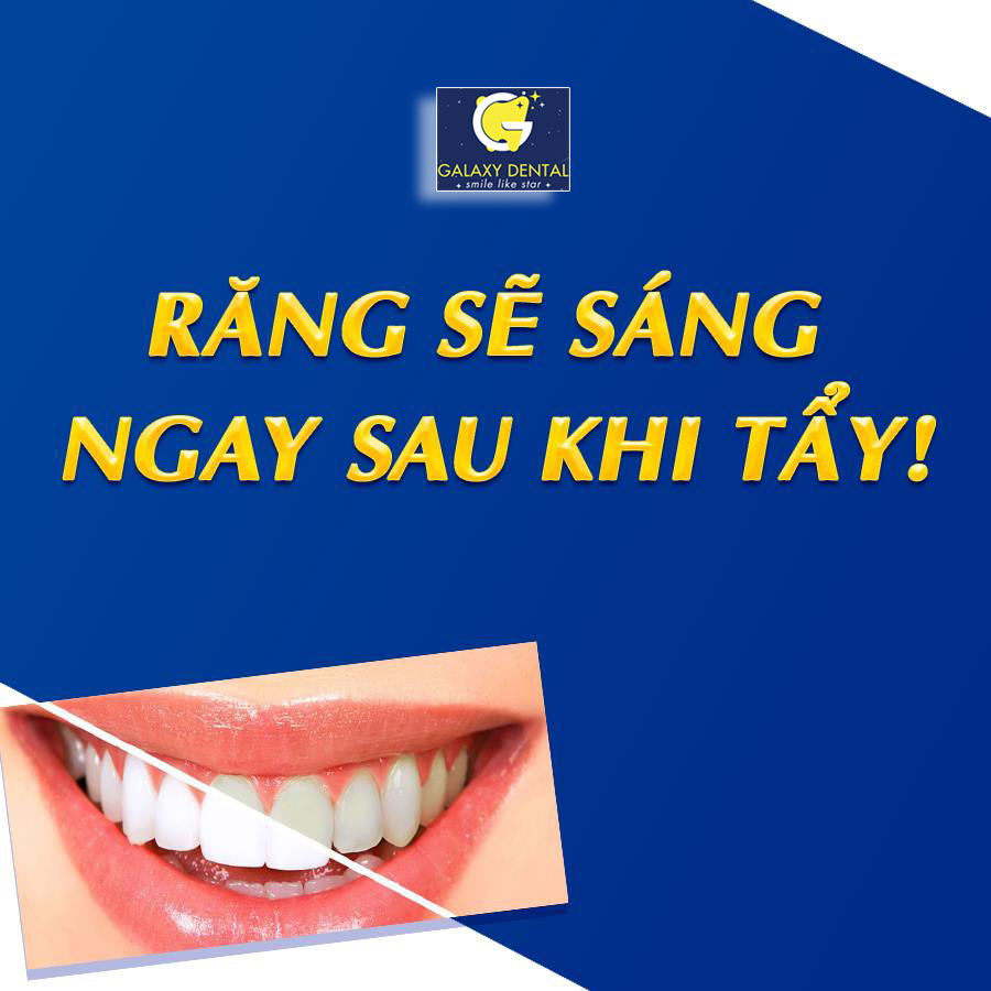 https://bacsynhakhoa.vn/img/galaxy-dental-tay-trang-rang2.jpg