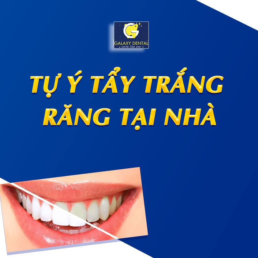 https://bacsynhakhoa.vn/img/galaxy-dental-tay-trang-rang3.jpg