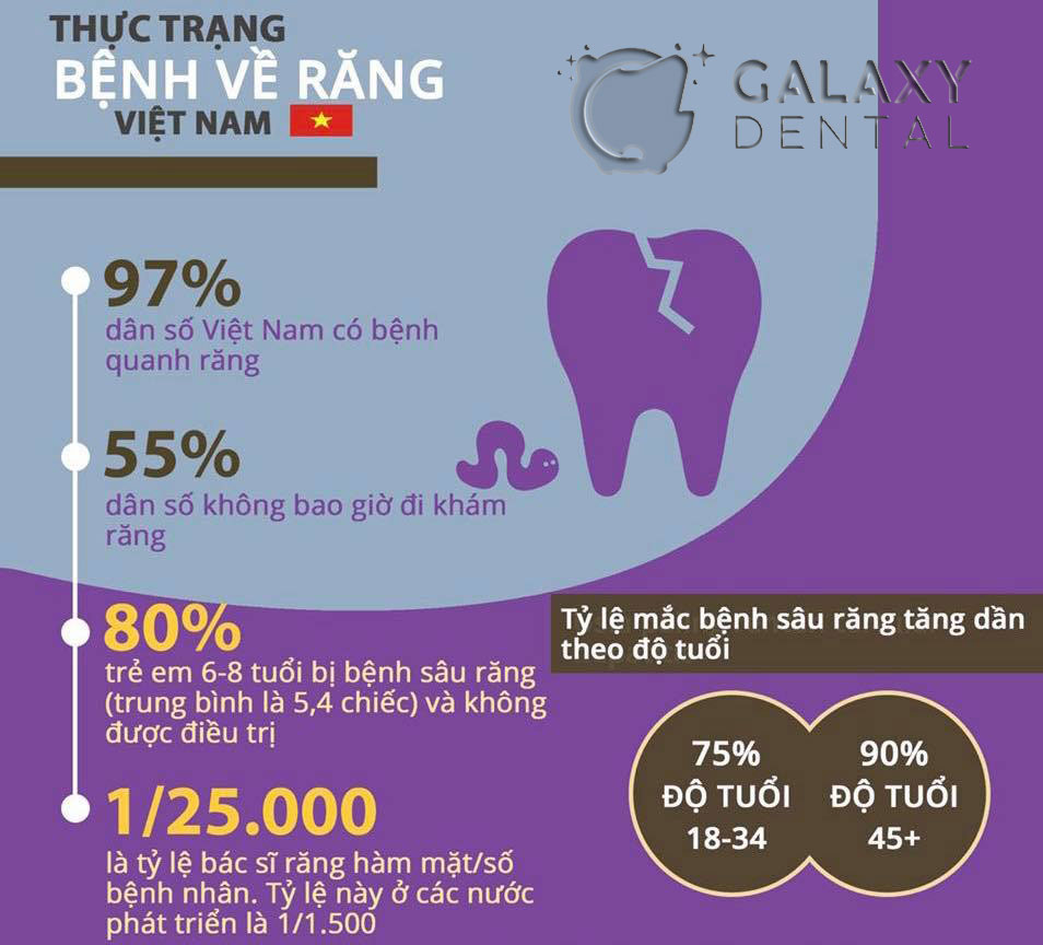 https://bacsynhakhoa.vn/img/galaxy-dental-thuc-trang-suc-khoe-rang-mieng-nguoi-viet-nam.jpg