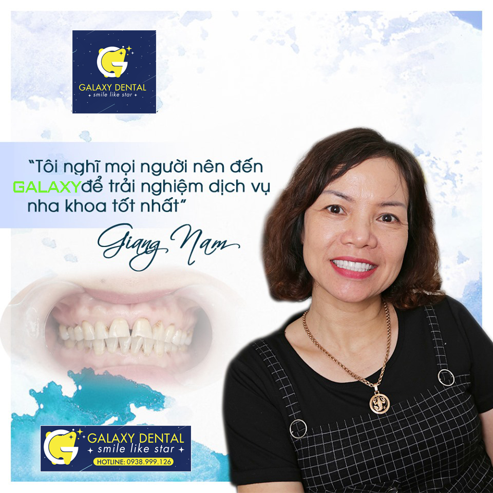 https://bacsynhakhoa.vn/img/galaxy-dental-trai-nghiem-dich-vu-tot-nhat-ve-nha-khoa.jpg