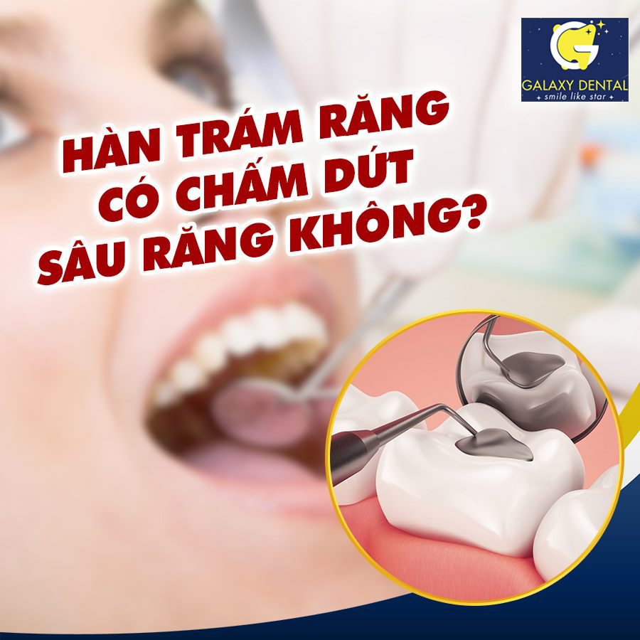 https://bacsynhakhoa.vn/img/galaxy-dental-tram-rang-co-dut-sau-rang-khong.jpg