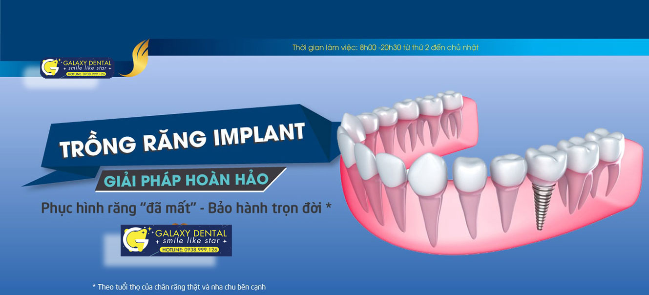 https://bacsynhakhoa.vn/img/galaxy-dental-trong-rang-implant-bao-hanh-tron-doi.jpg