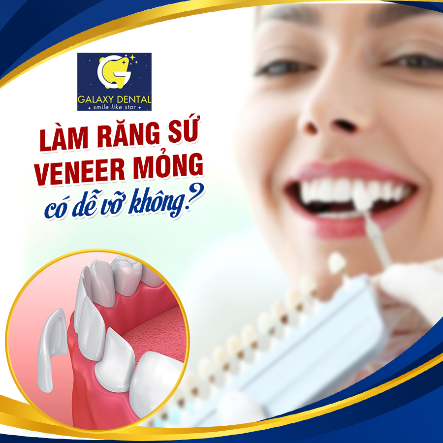 https://bacsynhakhoa.vn/img/galaxy-dental-veneer-co-de-vo-khong.jpg