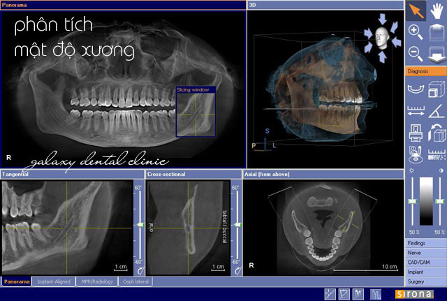 https://bacsynhakhoa.vn/img/galaxy-dentalmay-chup-phim-ct-cone-beam5.jpg