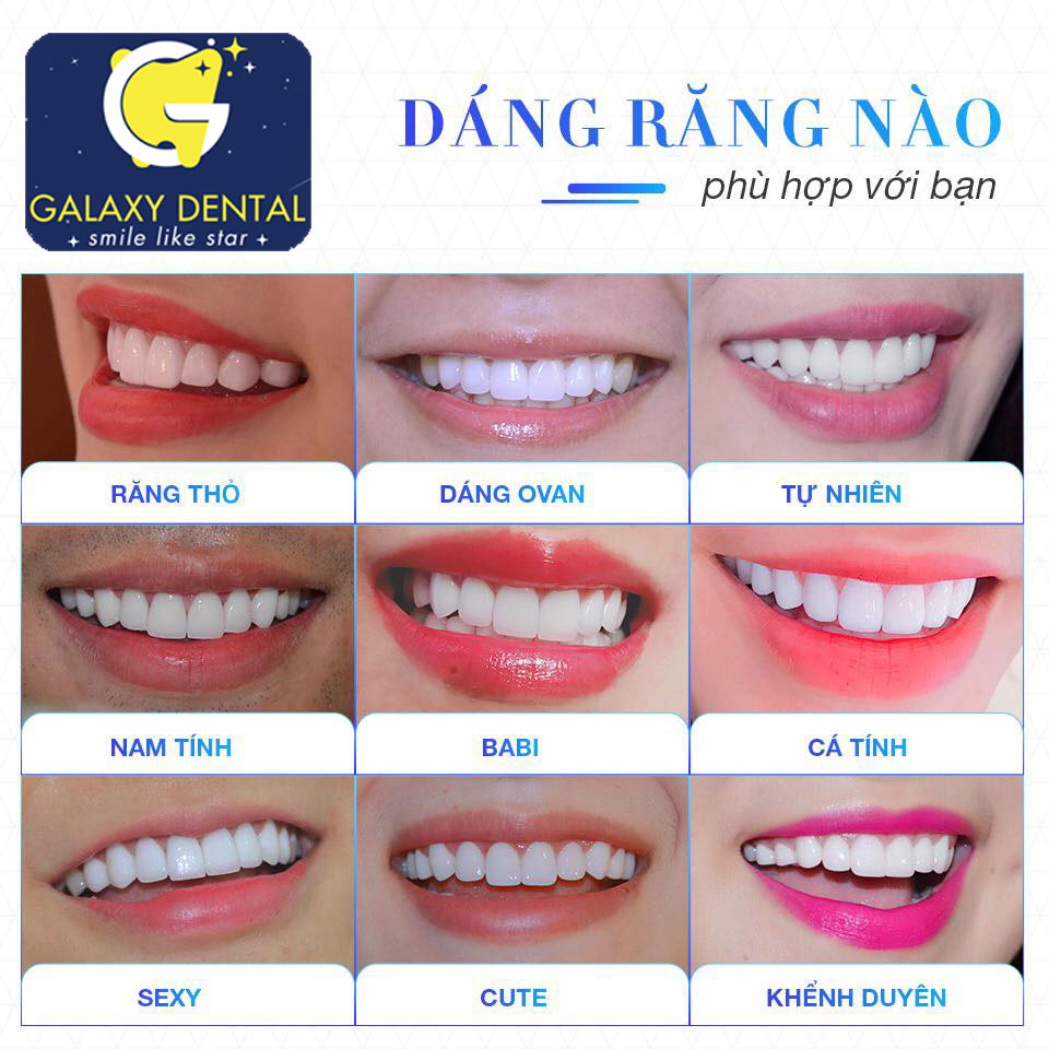 https://bacsynhakhoa.vn/img/galaxydental-lam-rang-su-co-dau-khong2.jpg