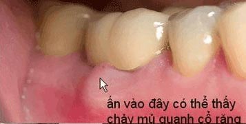 https://bacsynhakhoa.vn/img/galaxydental-tui-nha-chu.jpg