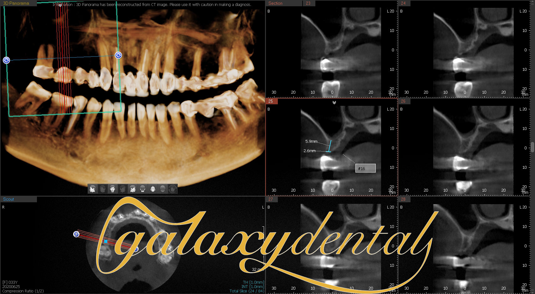 https://bacsynhakhoa.vn/uploads/galaxy-dental-cay-ghep-implant-nha-khoa.jpg