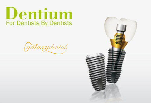 https://bacsynhakhoa.vn/uploads/galaxy-dental-implant-dentium.png