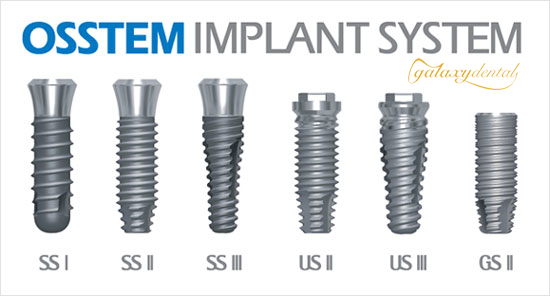 https://bacsynhakhoa.vn/uploads/galaxy-dental-implant-osstem.png